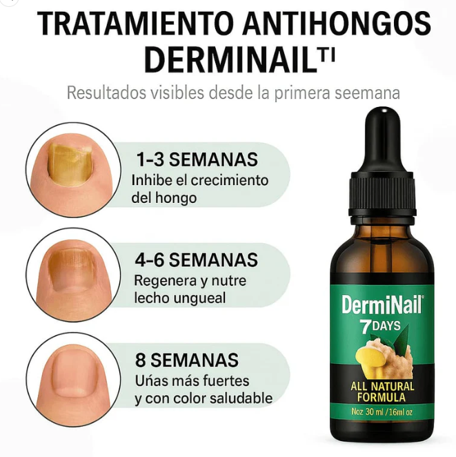 Derminail - TRATAMIENTO ANTI HONGOS 7 DÍAS 100% NATURAL