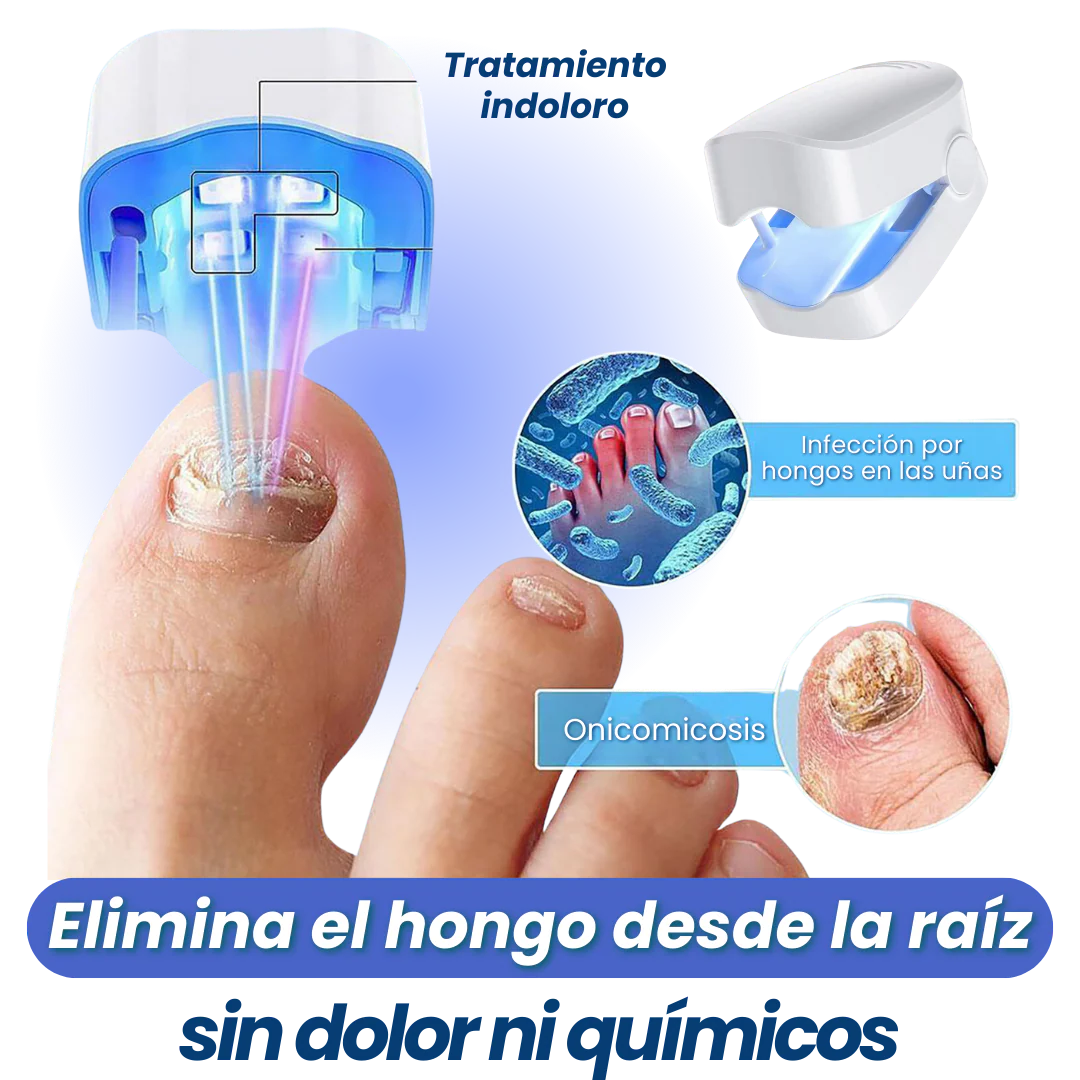 Elimina Hongos desde la Raíz sin Dolor 💥 | Tecnología LED en solo 7 minutos al día