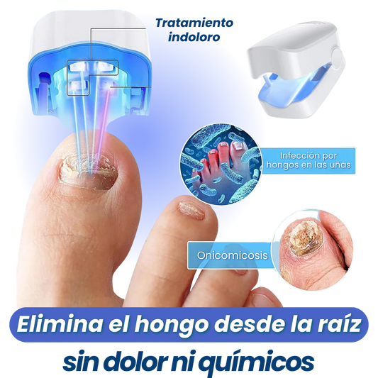 Elimina Hongos desde la Raíz sin Dolor 💥 | Tecnología LED en solo 7 minutos al día