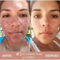 Crema 345 — Tu piel, sin manchas y más luminosa