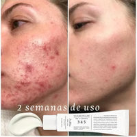 Crema 345 — Tu piel, sin manchas y más luminosa