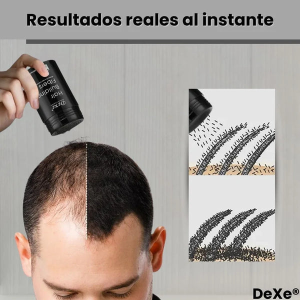 Fibras Capilares Densificadoras Instantáneas Contra Calvicie