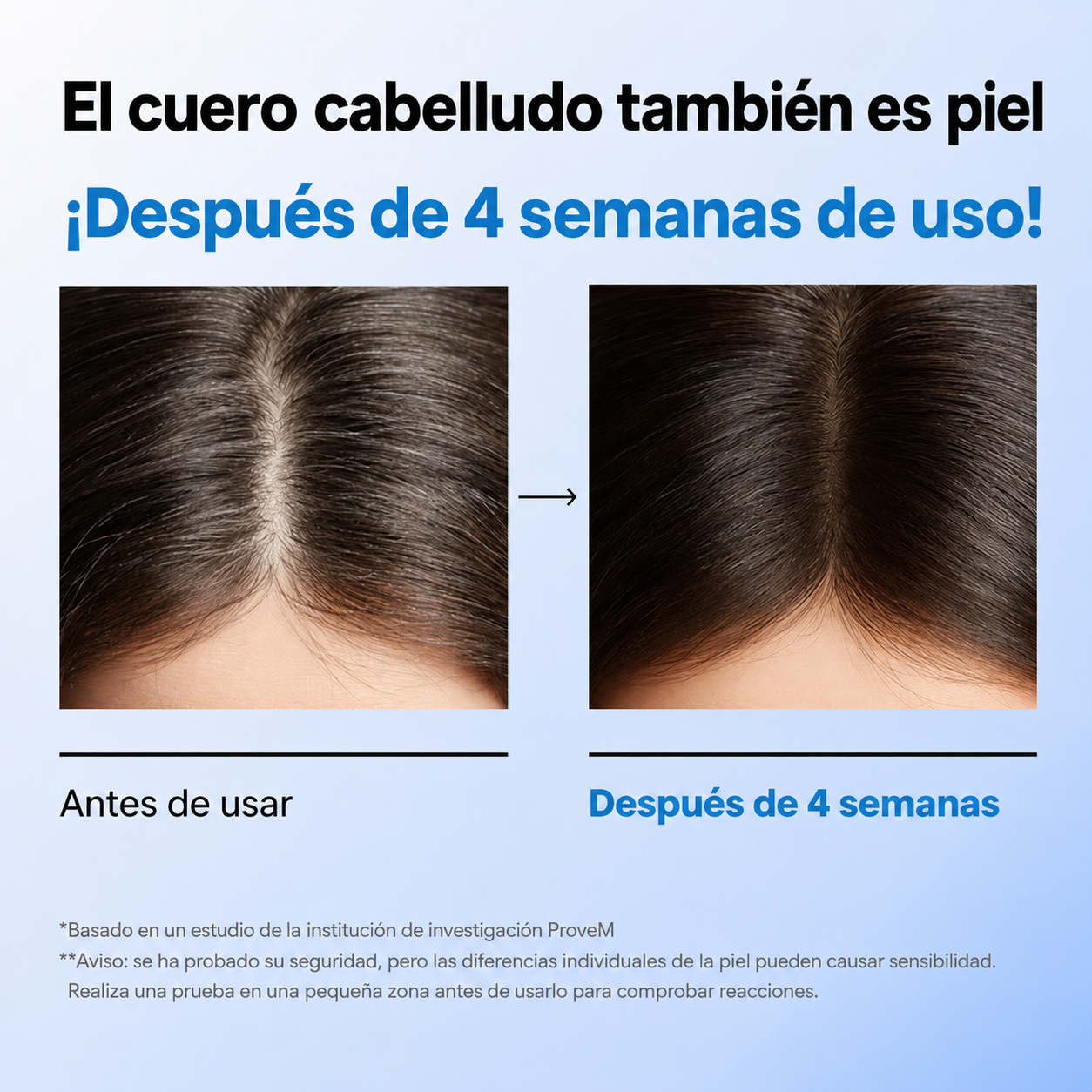 Sérum Seapuri Scalpy para el crecimiento del cabello, para hombres y mujeres, para la caída y el adelgazamiento del cabello