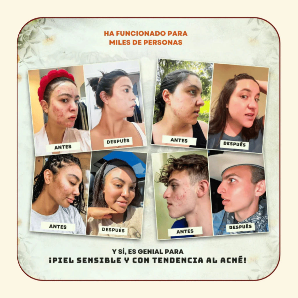 SEBO DE RES EVIL GOODS  Hidratación intensa que nutre, protege y revitaliza tu piel desde la primera aplicación.