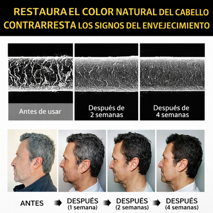 🔥 Luce Hasta 10 Años Más Joven™ | Shampoo Cubre Canas