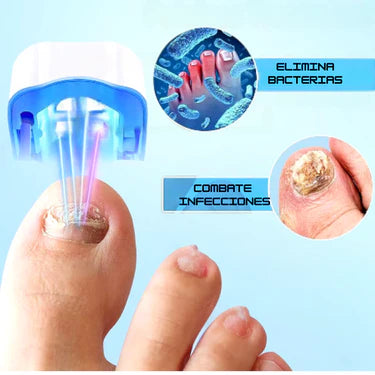 Elimina Hongos desde la Raíz sin Dolor 💥 | Tecnología LED en solo 7 minutos al día