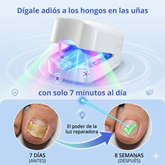 Elimina Hongos desde la Raíz sin Dolor 💥 | Tecnología LED en solo 7 minutos al día