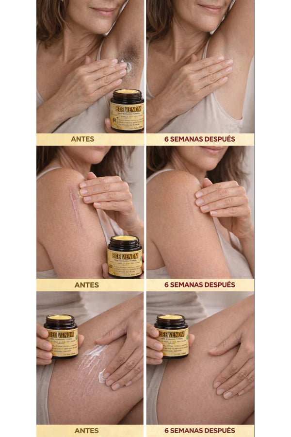 Crema Reparadora Veneno Abeja Pura Premium