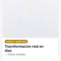 Ahorrador De Energia Luz Electricidad — antes-despues