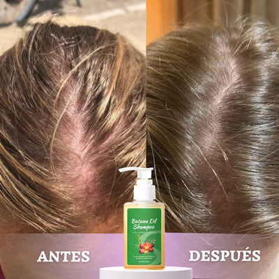 Antes