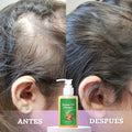 💇‍♀️ Batana Anti-Caída™ – Más Cabello, Menos Pérdida 🔥 Ayuda a fortalecer desde la raíz.