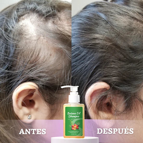 💇‍♀️ Batana Anti-Caída™ – Más Cabello, Menos Pérdida 🔥 Ayuda a fortalecer desde la raíz.