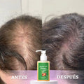 💇‍♀️ Batana Anti-Caída™ – Más Cabello, Menos Pérdida 🔥 Ayuda a fortalecer desde la raíz.